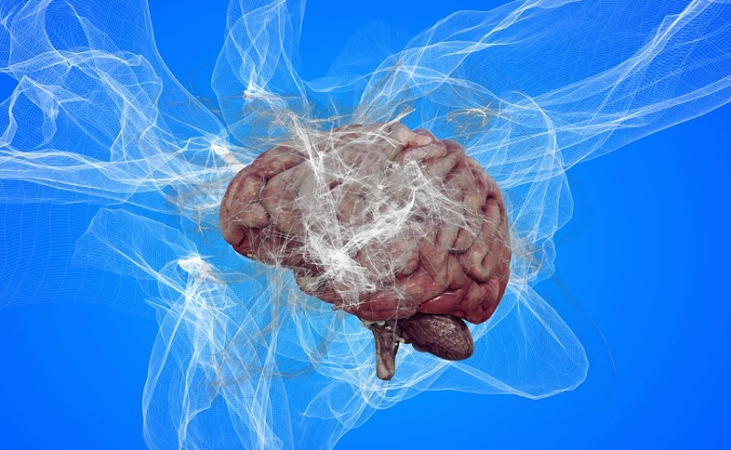 Alzheimer-kór emberi agy