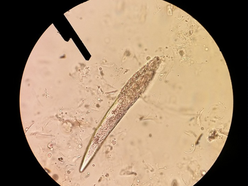 Demodex atkák