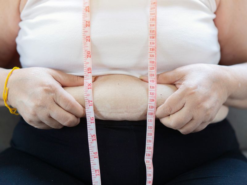 Miért nem elég a diéta és a mozgás? Ezek az elhízás okai