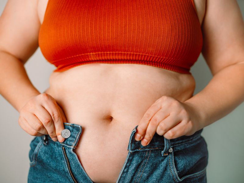 Hasi zsír lerakódása: ezek az ételek hizlalnak leginkább, és így váltsd ki őket