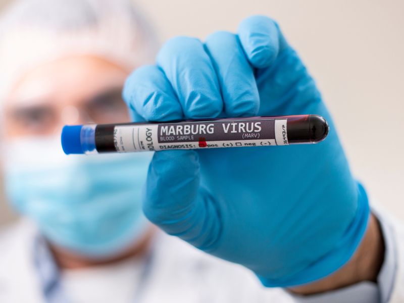 Marburg-vírus