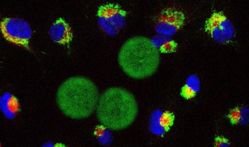 Mikrorobotok rákos sejtek elpusztítására