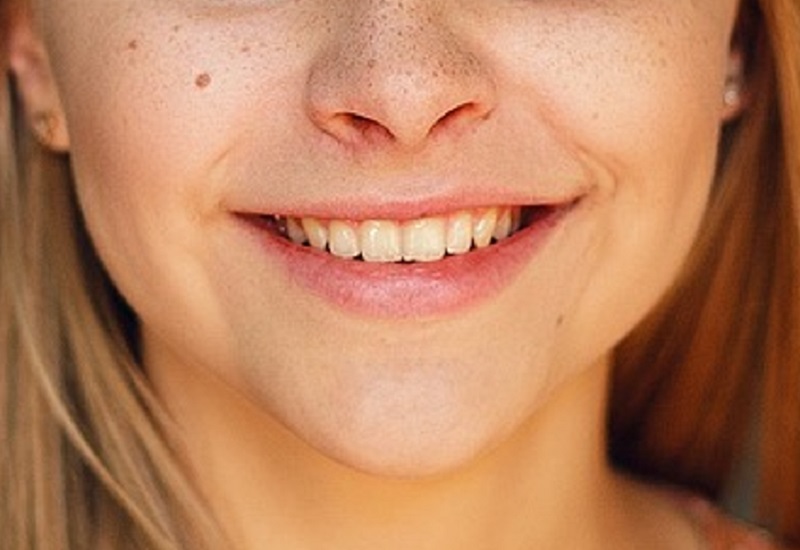 Mosolygós depresszió 