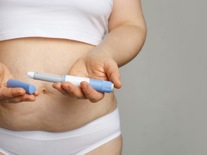 Az Ozempic mellékhatása az izomvesztés lehet