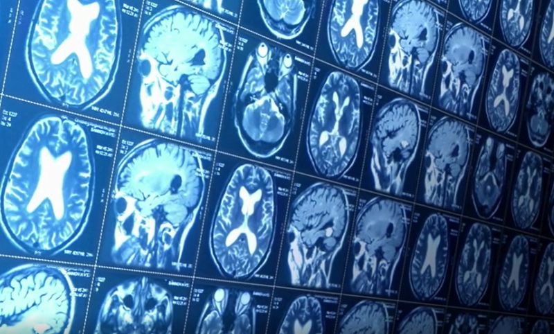 Hála és pozitív gondolkodás