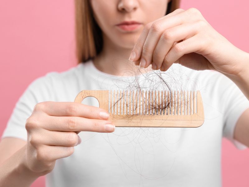 A tápanyaghiány hajhullást is okozhat.