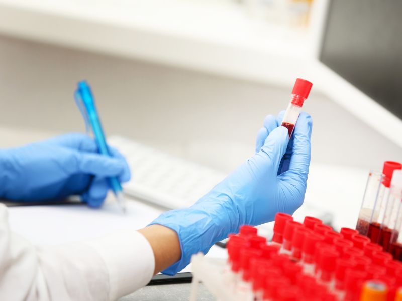 Belső kapacitás vizsgálata vérből